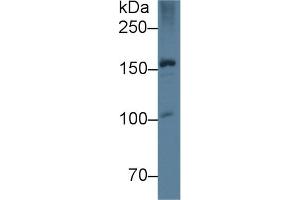 Detection of APOB in Rat Liver lysate using Monoclonal Antibody to Apolipoprotein B (APOB) (APOB anticorps  (AA 2747-2913))
