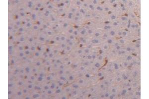 Detection of FABP4 in Mouse Liver Tissue using Polyclonal Antibody to Fatty Acid Binding Protein 4 (FABP4) (FABP4 anticorps  (AA 2-132))