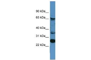 WB Suggested Anti-CANX  Antibody Titration: 0. (Calnexin anticorps  (C-Term))