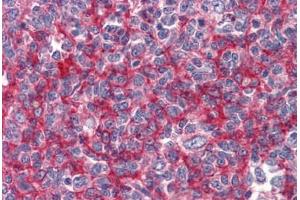 Human Tonsil: Formalin-Fixed, Paraffin-Embedded (FFPE)