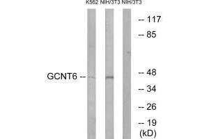 Western blot analysis of extracts from K562 cells and NIH/3T3 cells, using GCNT6 antibody.