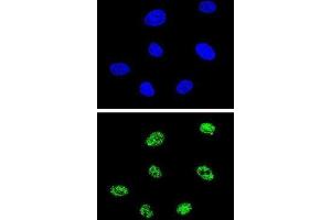 Immunofluorescence (IF) image for anti-Tumor Protein P73 (TP73) antibody (ABIN3003949)