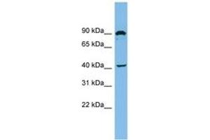 Image no. 1 for anti-Zinc Finger, MYND Domain Containing 12 (ZMYND12) (AA 35-84) antibody (ABIN6744891) (ZMYND12 anticorps  (AA 35-84))