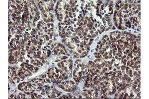 anti-Armadillo Repeat Containing 1 (ARMC1) antibody