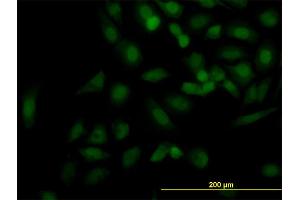 Immunofluorescence of monoclonal antibody to KIF2C on HeLa cell.