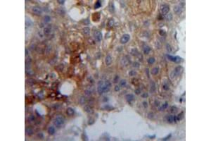 IHC-P analysis of Lung tissue, with DAB staining. (GP5 anticorps  (AA 17-242))