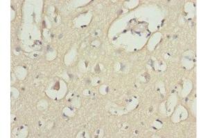 Immunohistochemistry of paraffin-embedded human brain tissue using ABIN7143362 at dilution of 1:100 (MOCS3 anticorps  (AA 271-460))
