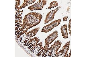 IHC analysis of NR1I2 using anti-NR1I2 antibody (ABIN7602331).
