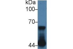 Detection of NUP62 in Human A431 cell lysate using Polyclonal Antibody to Nucleoporin 62 (NUP62) (NUP62 anticorps  (AA 186-432))