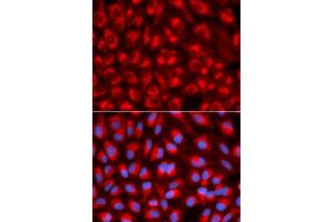 Immunofluorescence analysis of U2OS cell using TFAM antibody. (TFAM anticorps)