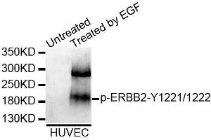 Western blot analysis of extracts of HUVEC cell line, using Phospho-ERBB2-Y1221/1222 antibody (ABIN5995602). (ErbB2/Her2 anticorps  (pTyr1221, pTyr1222))