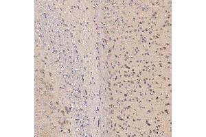 IHC analysis of Septin 11/SEPTIN11 using anti-Septin 11/SEPTIN11 antibody (ABIN7602925). (Septin 11 anticorps  (C-Term))