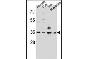 RIC3 Antibody (C-term) (ABIN656649 and ABIN2845890) western blot analysis in NCI-,A549,WiDr,MDA-M cell line lysates (35 μg/lane). (RIC3 anticorps  (C-Term))