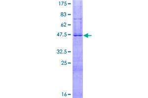 Image no. 1 for HESX Homeobox 1 (HESX1) (AA 1-185) protein (GST tag) (ABIN1306555)