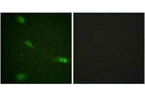 Immunofluorescence analysis of NIH-3T3 cells, using MDM2 (Ab-166) Antibody. (MDM2 anticorps  (AA 132-181))
