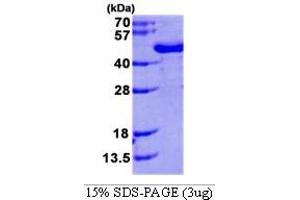 N-Acetyltransferase 6 (GCN5-Related) (NAT6) (AA 1-308) protein (His tag)