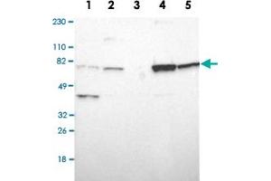 Western Blot analysis of Lane 1: RT-4, Lane 2: U-251MG sp, Lane 3: human plasma (IgG/HSA depleted), Lane 4: human liver and Lane 5: human tonsil lysates with ASMTL polyclonal antibody . (ASMTL anticorps)