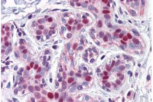 Human Breast: Formalin-Fixed, Paraffin-Embedded (FFPE)