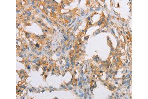 Immunohistochemistry (IHC) image for anti-Actin-Related Protein 2 (ACTR2) antibody (ABIN2429273) (ACTR2 anticorps)