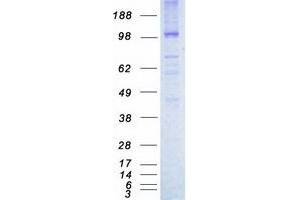 Validation with Western Blot