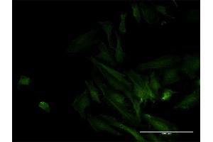 Immunofluorescence of monoclonal antibody to ODF2 on HeLa cell.