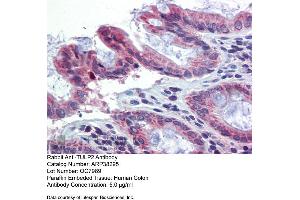 Immunohistochemistry with Human Colon lysate tissue at an antibody concentration of 5.