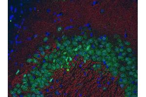 Indirect immunostaining of PFA fixed paraffin embedded mouse hippocampus section with anti-bassoon (dilution 1 : 500; red) and Guinea pig anti-NeuN (cat.