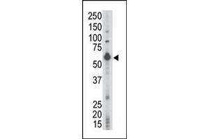 Western Blotting (WB) image for anti-Lymphocyte-Specific Protein tyrosine Kinase (LCK) (N-Term) antibody (ABIN359986) (LCK anticorps  (N-Term))