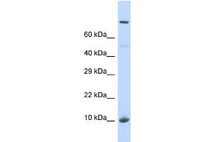 Western Blotting (WB) image for anti-NOP2/Sun Domain Family, Member 5 Pseudogene 1 (NSUN5P1) (N-Term) antibody (ABIN2785123) (NSUN5P1 anticorps  (N-Term))
