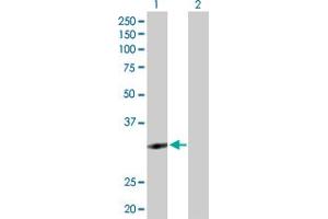 Western Blot analysis of ZNF124 expression in transfected 293T cell line by ZNF124 MaxPab polyclonal antibody. (ZNF124 anticorps  (AA 1-289))