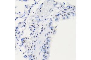 Immunohistochemistry of paraffin-embedded mouse lung using DNA Ligase I Rabbit mAb (ABIN7268251) at dilution of 1:100 (40x lens).