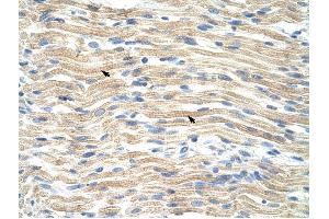 EXOSC6 antibody was used for immunohistochemistry at a concentration of 4-8 ug/ml to stain Skeletal muscle cells (arrows) in Human Muscle. (EXOSC6 anticorps  (N-Term))