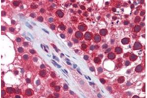 Human Testis: Formalin-Fixed, Paraffin-Embedded (FFPE)