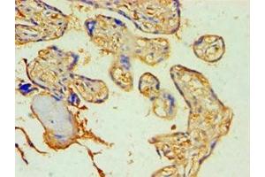 Immunohistochemistry of paraffin-embedded human placenta tissue using ABIN7170995 at dilution of 1:100 (SOCS2 anticorps  (AA 1-198))