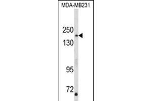 Western blot analysis of TBC1D4 Antibody (N-term) (ABIN652462 and ABIN2842314) in MDA-M cell line lysates (35 μg/lane). (TBC1D4 anticorps  (N-Term))