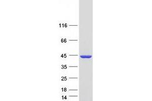 Validation with Western Blot