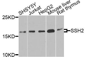 Western blot analysis of extracts of various cells, using SSH2 antibody. (SSH2 anticorps)