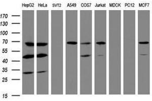 Image no. 3 for anti-IlvB (Bacterial Acetolactate Synthase)-Like (ILVBL) antibody (ABIN1498882) (ILVBL anticorps)