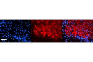 Rabbit Anti-CSF1 Antibody    Formalin Fixed Paraffin Embedded Tissue: Human Adult liver  Observed Staining: Cytoplasmic Primary Antibody Concentration: 1:600 Secondary Antibody: Donkey anti-Rabbit-Cy2/3 Secondary Antibody Concentration: 1:200 Magnification: 20X Exposure Time: 0. (M-CSF/CSF1 anticorps  (N-Term))
