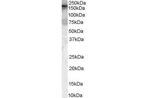 Western Blotting (WB) image for anti-Chromosome 14 Open Reading Frame 119 (C14ORF119) (N-Term) antibody (ABIN2787045) (C14ORF119 anticorps  (N-Term))