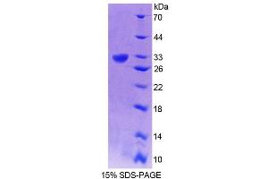 SDS-PAGE analysis of Human GRIK2 Protein.