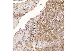 Immunohistochemistry of paraffin-embedded human tonsil using ERp19 Rabbit mAb (ABIN7270799) at dilution of 1:200 (40x lens).