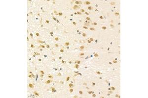 Immunohistochemistry of paraffin embedded rat brain using PGBD5 (ABIN7075082) at dilution of 1:2000 (400x lens) (PGBD5 anticorps)
