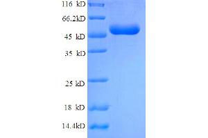 SDS-PAGE (SDS) image for Heat Shock 22kDa Protein 8 (HSPB8) (AA 2-213) protein (GST tag) (ABIN5709655)