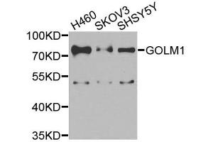 Western blot analysis of extracts of various cell lines, using GOLM1 antibody. (GOLM1 anticorps  (AA 112-401))