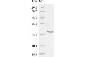 (Tris-Glycine gel) Discontinuous SDS-PAGE (reduced) with 5 % enrichment gel and 15 % separation gel.