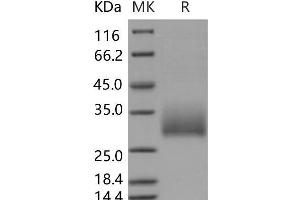 Western Blotting (WB) image for Killer Cell Lectin-Like Receptor Subfamily B Member 1A (Klrb1a) protein (His tag) (ABIN7320141)