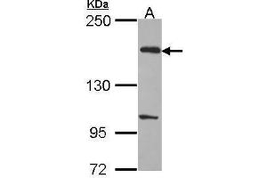 WB Image Sample (30 ug of whole cell lysate) A: H1299 5% SDS PAGE EVC2 antibody antibody diluted at 1:1000 (EVC2 anticorps  (C-Term))