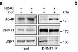Acetylation of KGDNMT1impairs DNMT1-USP7 interaction and promotes the degradation of DNMT1.