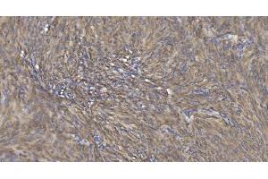IHC analysis of Alpha B Crystallin/CRYAB using anti-Alpha B Crystallin/CRYAB antibody (ABIN7601209). (CRYAB anticorps  (AA 30-151))